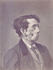 Civil War facial wound.